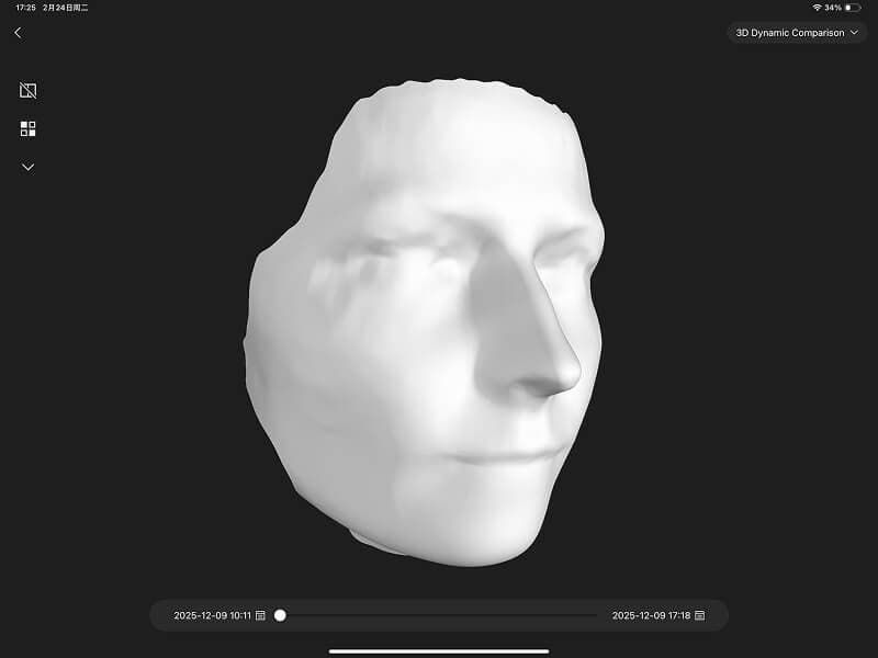 3D 疗效对比