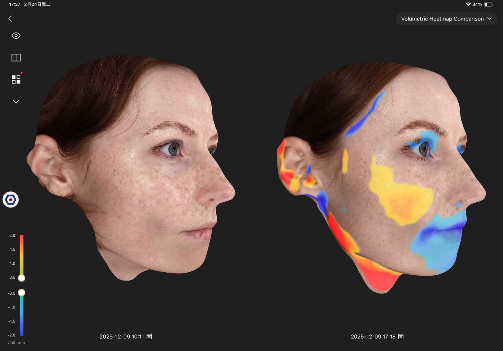 3D volumetric heatmap comparison