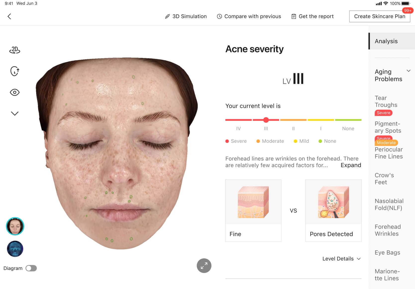 New Visual Theme UI 2.0 skin analysis report